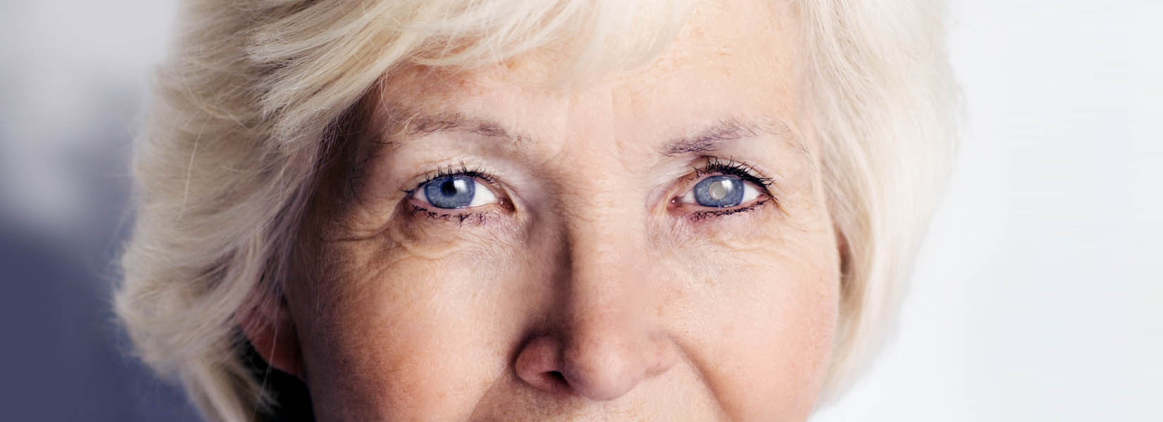 Cataract Surgery in Painesville